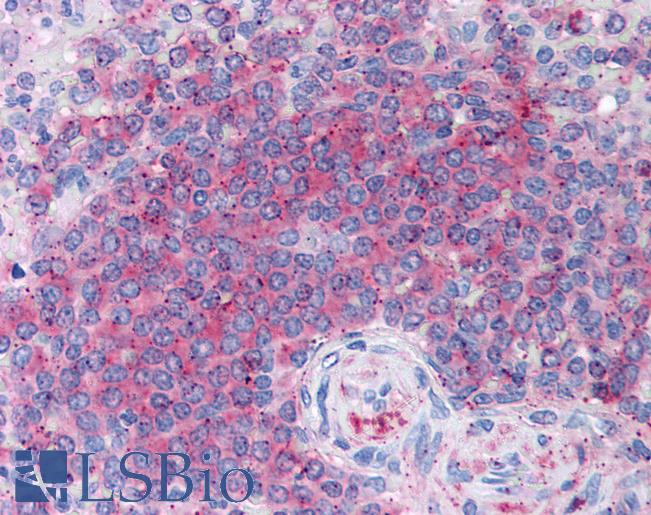 Anti-ATIC antibody IHC of human spleen. Immunohistochemistry of formalin-fixed, paraffin-embedded tissue after heat-induced antigen retrieval. Antibody LS-B1662 concentration 15 ug/ml.