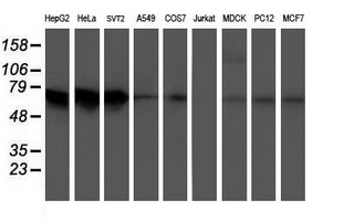 Western blot of extracts (35 ug) from 9 different cell lines by using anti-ATIC monoclonal antibody.