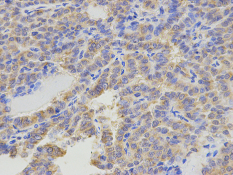 Immunohistochemistry of paraffin-embedded human esophagus using ATIC antibody at dilution of 1:200 (400x lens).