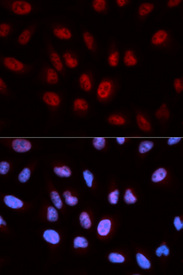 Immunofluorescence analysis of U20S cell using ATIC antibody. Blue: DAPI for nuclear staining.