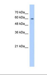 HepG2 cell lysate. Antibody concentration: 1.25 ug/ml. Gel concentration: 12%.