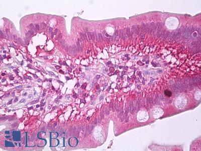 Anti-ATIC antibody IHC of human small intestine. Immunohistochemistry of formalin-fixed, paraffin-embedded tissue after heat-induced antigen retrieval. Antibody LS-B7299 concentration 10 ug/ml.