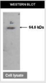 ATIC Antibody (F38 P7 H9) - ATIC detected at 64.5kDa
