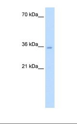 Jurkat cell lysate. Antibody concentration: 5.0 ug/ml. Gel concentration: 12%.
