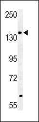 ABCB4-S639 western blot of mouse heart tissue lysates (35 ug/lane). The ABCB4 antibody detected ABCB4 protein (arrow).