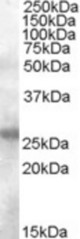 Antibody (0.1 ug/ml) staining of Human Tonsil lysate (35 ug protein in RIPA buffer). Primary incubation was 1 hour. Detected by chemiluminescence.