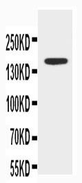 WB of ABCB4 / MDR3 antibody. WB: MCF-7 Cell Lysate.