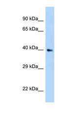 AIDA antibody LS-C146060 Western blot of 293T Cell lysate. Antibody concentration 1 ug/ml.