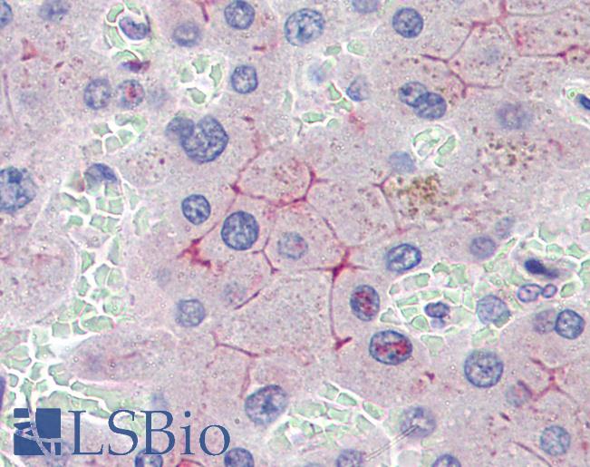 Anti-ABCB4 antibody IHC of human liver. Immunohistochemistry of formalin-fixed, paraffin-embedded tissue after heat-induced antigen retrieval. Antibody LS-B4112 concentration 3.75 ug/ml.