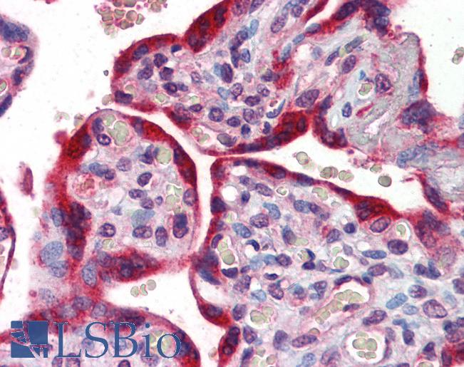 Anti-ABCB4 antibody IHC of human placenta. Immunohistochemistry of formalin-fixed, paraffin-embedded tissue after heat-induced antigen retrieval. Antibody LS-B5729 concentration 5 ug/ml.