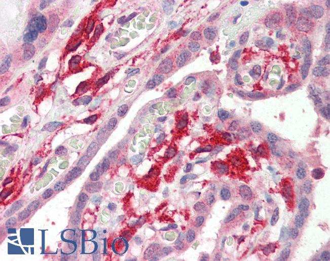 Anti-AIF1 / IBA1 antibody IHC of human placenta. Immunohistochemistry of formalin-fixed, paraffin-embedded tissue after heat-induced antigen retrieval. Antibody LS-B2403 concentration 5 ug/ml.