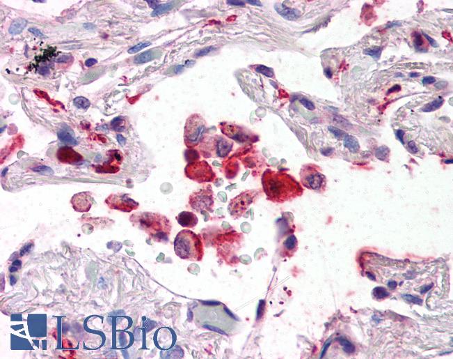 Anti-AIF1 / IBA1 antibody IHC of human lung. Immunohistochemistry of formalin-fixed, paraffin-embedded tissue after heat-induced antigen retrieval. Antibody LS-B2645 concentration 5 ug/ml.