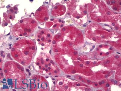 Anti-ABCB5 antibody IHC of human kidney. Immunohistochemistry of formalin-fixed, paraffin-embedded tissue after heat-induced antigen retrieval. Antibody LS-B6371 concentration 2.5 ug/ml.