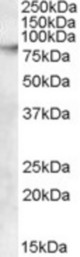 Antibody (0.03 ug/ml) staining of A431 cell lysate (35 ug protein in RIPA buffer). Primary incubation was 1 hour. Detected by chemiluminescence.