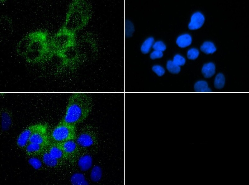 Immunocytochemistry/Immunofluorescence: ABCB5 Antibody - ABCB5 antibody was tested in A431 cells with FITC (green). Nuclei were counterstained with DAPI (blue).