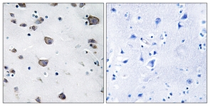 IHC of paraffin-embedded human brain, using AIFM3 Antibody. The picture on the right is treated with the synthesized peptide.