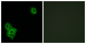 Immunofluorescence of A549 cells, using AIFM3 Antibody. The picture on the right is treated with the synthesized peptide.