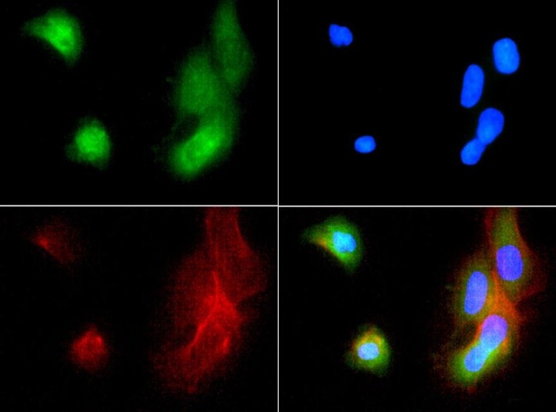 Immunocytochemistry/Immunofluorescence: ABCB5 Antibody - ABCB5 antibody was tested in A431 cells with FITC (green). Nuclei and actin were counterstained with DAPI (blue) and Phalloidin (red).
