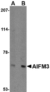 Western blot of NIPSNAP in human brain tissue lysate with NIPSNAP antibody at (A) 0.5 and (B) 1 ug/ml.