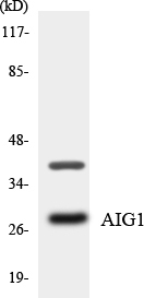 Western blot of the lysates from HT-29 cells using AIG1 antibody.