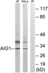 Western blot of extracts from HeLa/Jurkat cells, using AIG1 Antibody. The lane on the right is treated with the synthesized peptide.