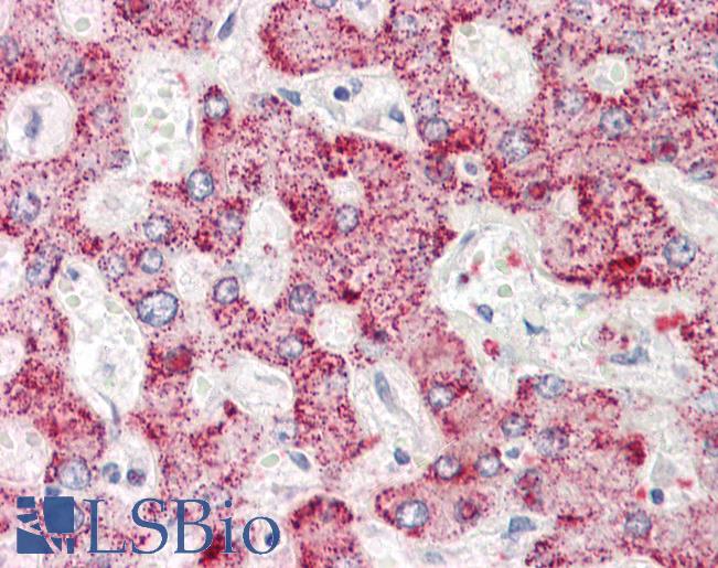 Anti-AIG1 antibody IHC staining of human liver. Immunohistochemistry of formalin-fixed, paraffin-embedded tissue after heat-induced antigen retrieval.