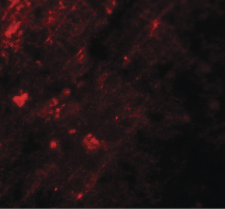 Immunofluorescence of AIG1 in human brain tissue with AIG1 antibody at 20 ug/ml.