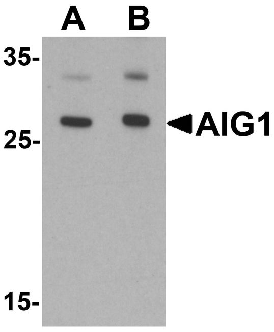 Western blot analysis of AIG1 in human brain tissue lysate with AIG1 antibody at (A) 1 and (B) 2 ug/ml.