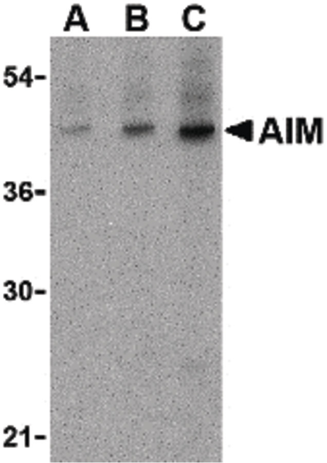 Western blot of AIM in human lymph node tissue lysate with AIM antibody at (A) 1, (B) 2 and (C) 4 ug/ml.