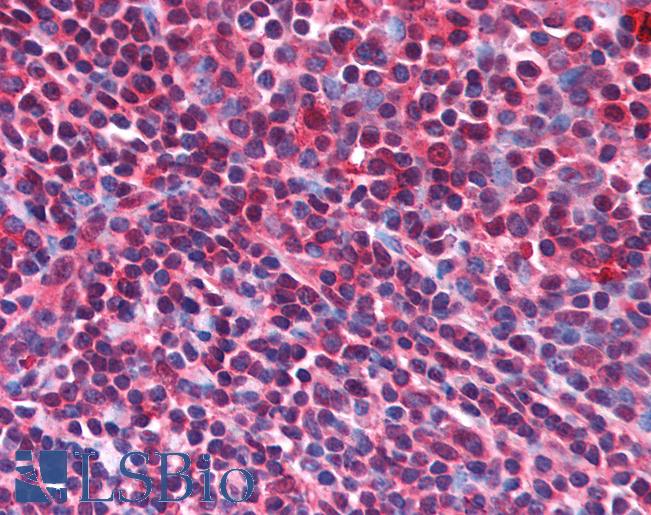 Anti-CD5L antibody IHC of human tonsil. Immunohistochemistry of formalin-fixed, paraffin-embedded tissue after heat-induced antigen retrieval. Antibody LS-B711 concentration 5 ug/ml.