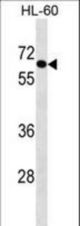 AIM1L Antibody western blot of HL-60 cell line lysates (35 ug/lane). The AIM1L antibody detected the AIM1L protein (arrow).