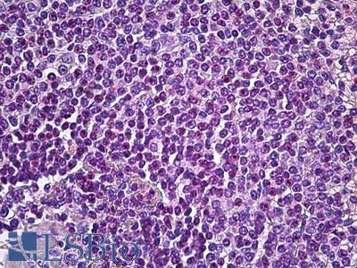 Anti-AIM2 antibody IHC of human spleen. Immunohistochemistry of formalin-fixed, paraffin-embedded tissue after heat-induced antigen retrieval. Antibody LS-B5945 concentration 3.75 ug/ml.