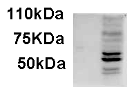 Antibody staining of IFNbeta-treated WI-38 lysate (35 ug protein in RIPA buffer). Primary incubation was 1 hour. Detected by chemiluminescence.