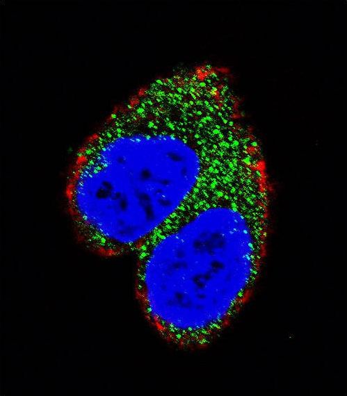 Confocal immunofluorescent of AIM2 Antibody with MCF-7 cell followed by Alexa Fluor 488-conjugated goat anti-rabbit lgG (green). Actin filaments have been labeled with Alexa Fluor 555 phalloidin (red). DAPI was used to stain the cell nuclear (blue).