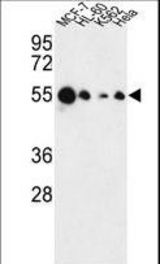Western blot of AIM2 Antibody in MCF-7, HL-60, K562, HeLa cell line lysates (35 ug/lane). AIM2 (arrow) was detected using the purified antibody.