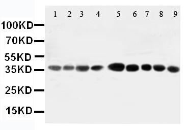WB of AIMP2 antibody. All lanes: Anti-AIMP2 at 0.5ug/ml. Lane 1: Rat Liver Tissue Lysate at 40ug. Lane 2: Rat Lung Tissue Lysate at 40ug. Lane 3: Rat Kidney Tissue Lysate at 40ug. Lane 4: Rat Brain Tissue Lysate at 40ug. Lane 5: JURKAT Whole Cell Lysate at 40ug. Lane 6: CEM Whole Cell Lysate at 40ug. Lane 7: HUT Whole Cell Lysate at 40ug. Lane 8: U93T Whole Cell Lysate at 40ug. Lane 9: U93T Whole Cell Lysate at 40ug. Predicted bind size: 35KD. Observed bind size: 35KD.