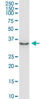 JTV1 monoclonal antibody (M02), clone 8E7. Western Blot analysis of JTV1 expression in K-562.