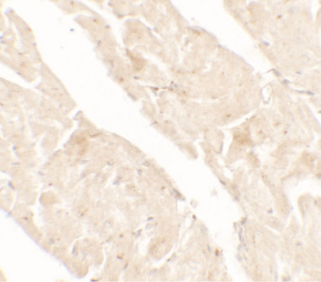 Immunohistochemistry of AIMP2 in rat small intestine tissue with AIMP2 antibody at 5 ug/ml.