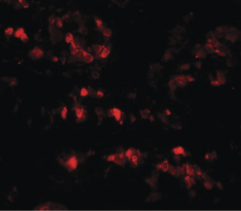 Immunofluorescence of AIMP2 in rat small intestine tissue with AIMP2 antibody at 20 ug/ml.