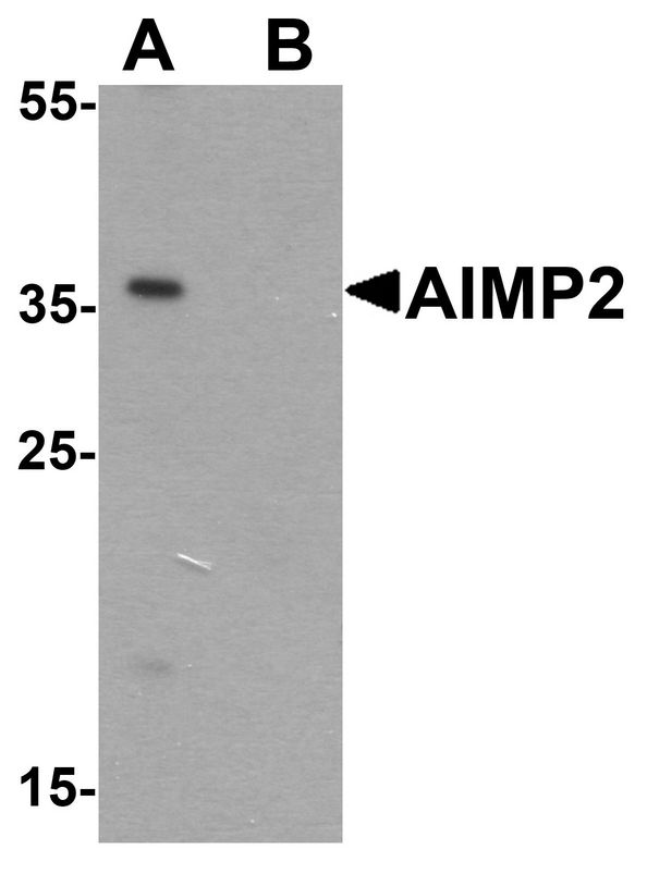 Western blot analysis of AIMP2 in HeLa cell lysate with AIMP2 antibody at 1 ug/ml in (A) the absence and (B) the presence of blocking peptide.