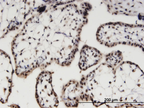 Immunoperoxidase of monoclonal antibody to AIPL1 on formalin-fixed paraffin-embedded human placenta. [antibody concentration 3 ug/ml]