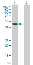 Western blot of AIPL1 expression in transfected 293T cell line by AIPL1 monoclonal antibody (M04), clone 1E1.