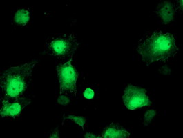 Anti-AIPL1 mouse monoclonal antibody immunofluorescent staining of COS7 cells transiently transfected by pCMV6-ENTRY AIPL1.