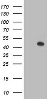 HEK293T cells were transfected with the pCMV6-ENTRY control (Left lane) or pCMV6-ENTRY AIPL1 (Right lane) cDNA for 48 hrs and lysed. Equivalent amounts of cell lysates (5 ug per lane) were separated by SDS-PAGE and immunoblotted with anti-AIPL1.
