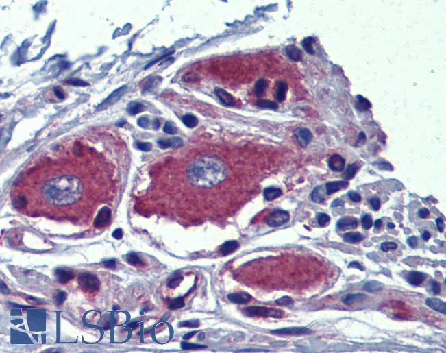 Anti-AIPL1 antibody IHC of human adrenal. Immunohistochemistry of formalin-fixed, paraffin-embedded tissue after heat-induced antigen retrieval. Antibody LS-B3854 concentration 5 ug/ml.