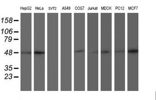 Western blot of extracts (35ug) from 9 different cell lines by using anti-AIPL1 monoclonal antibody.