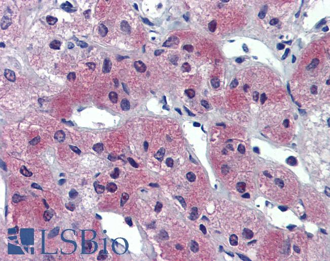 Anti-AIPL1 antibody IHC of human adrenal. Immunohistochemistry of formalin-fixed, paraffin-embedded tissue after heat-induced antigen retrieval. Antibody LS-B3848 concentration 5 ug/ml.
