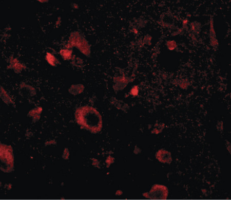 Immunofluorescence of aipl1 in human brain tissue with aipl1 antibody at 20 ug/ml.