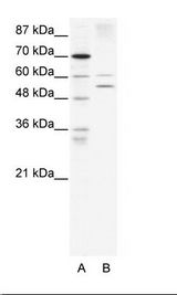 A: Marker, B: HepG2 Cell Lysate