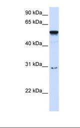 Placenta lysate. Antibody concentration: 1.0 ug/ml. Gel concentration: 12%.
